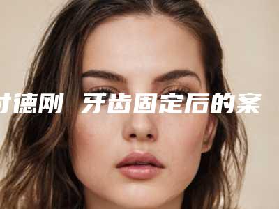 付德刚 牙齿固定后的案例效果图